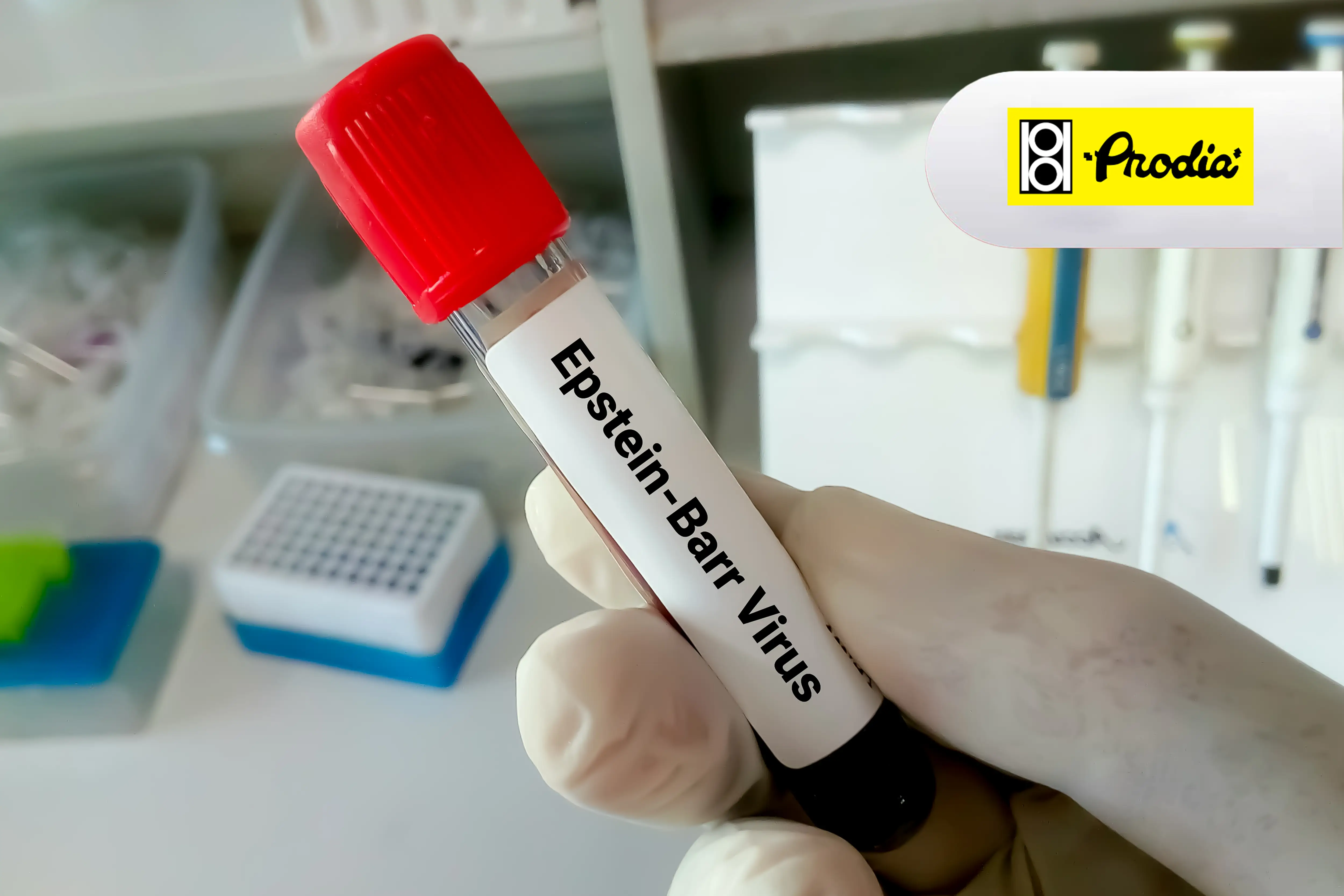 https://api.oneonco.co.id/storage/photo/product/Prodia-Epstein-Barr Virus Early Antigen IgA Antibodi_1721893788.webp